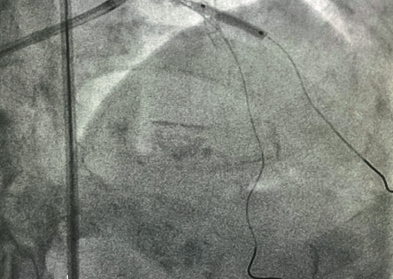Actualités vasculaires | Cardiologie Pratique