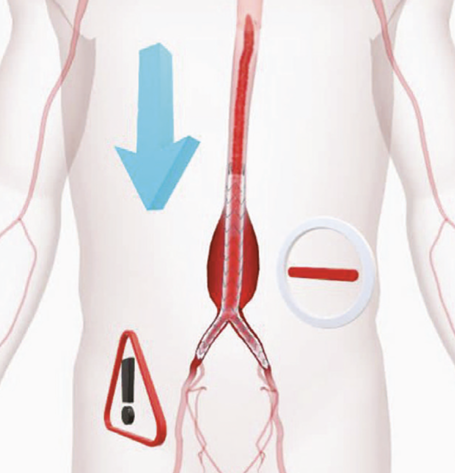 L'artère brachiale, cette mal-aimée | Cardiologie Pratique