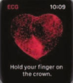 Recording an ECG with a connected watch: gadget or revolution?